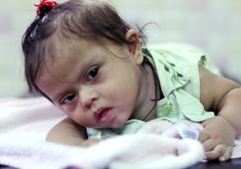 Cerebral Palsy Overview